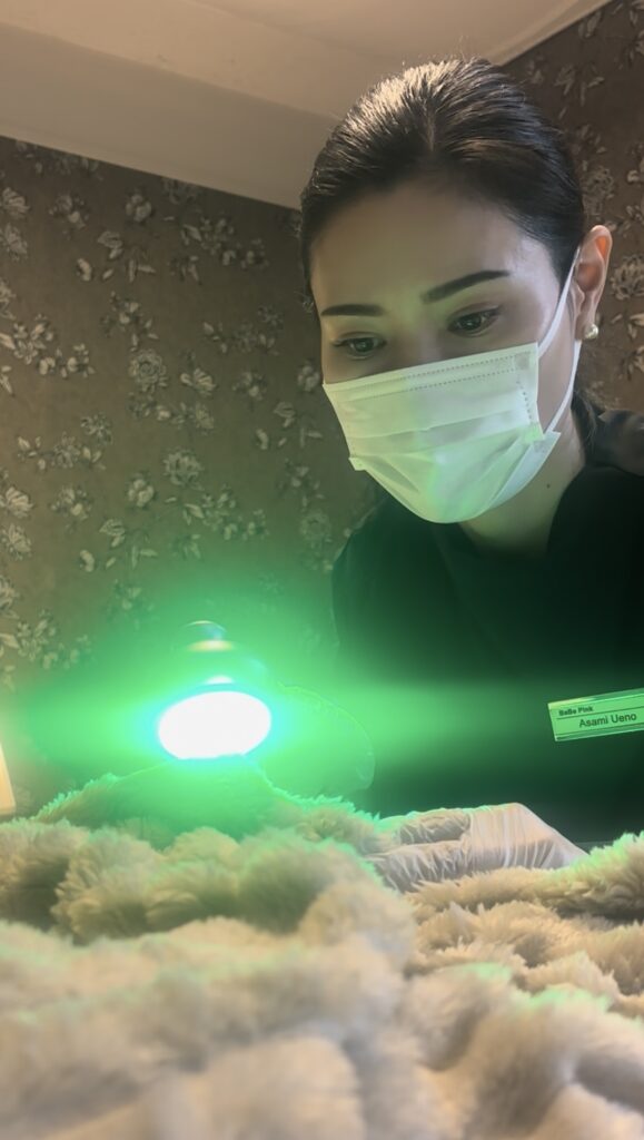 LED照射の施術している画像